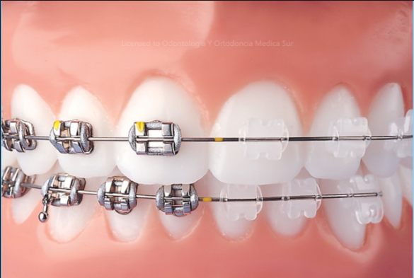 Ortodoncia - Dental Concept